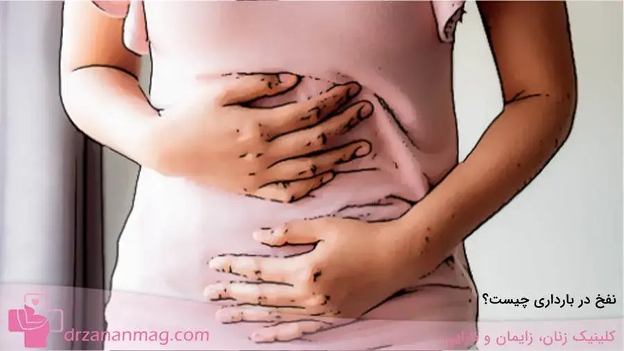 نفخ در بارداری 