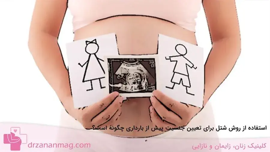 چگونگی روش شتل برای تعیین جنسیت قبل از حاملگی