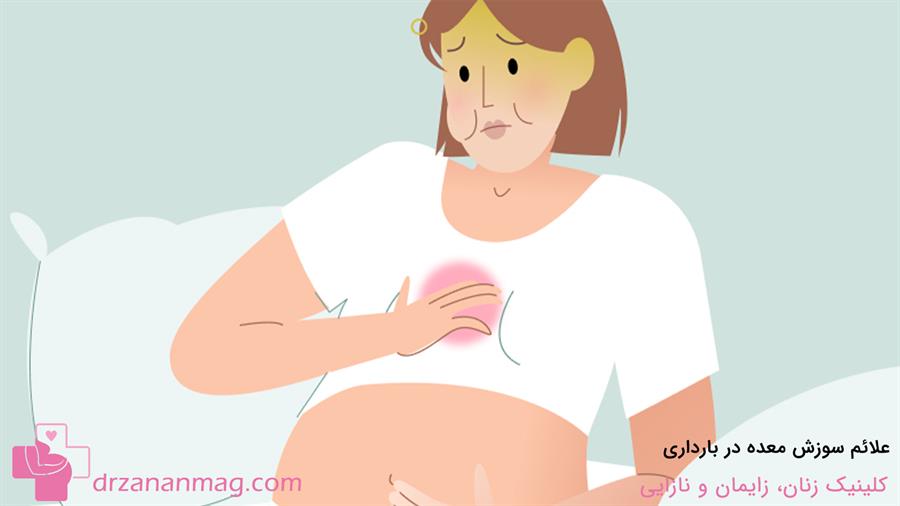 سوزش معده در بارداری چه علائمی دارد؟