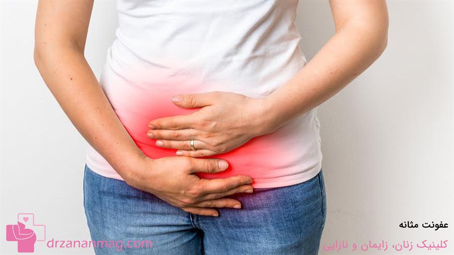 عفونت مثانه در بارداری