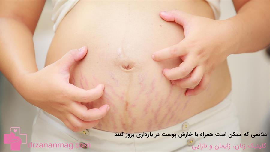 علائمی که ممکن است همراه با خارش پوستی در بارداری ظاهر شوند