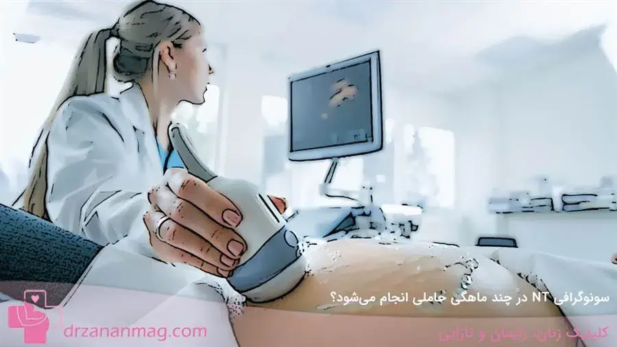 سونوگرافی NT در چند ماهگی حاملی انجام می‌شود؟
