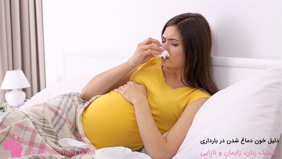 علت خون دماغ شدن در بارداری چیست؟