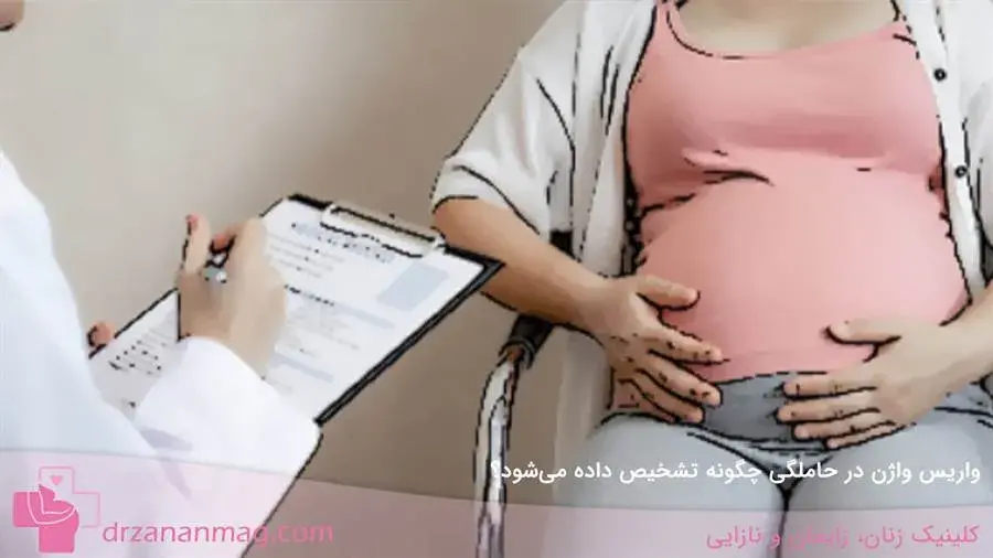 نحوه تشخیص واریس واژن در بارداری