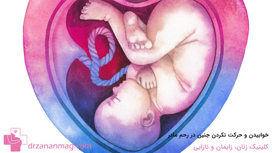 حرکت نکردن جنین در رحم مادر به دلیل خوابیدن او