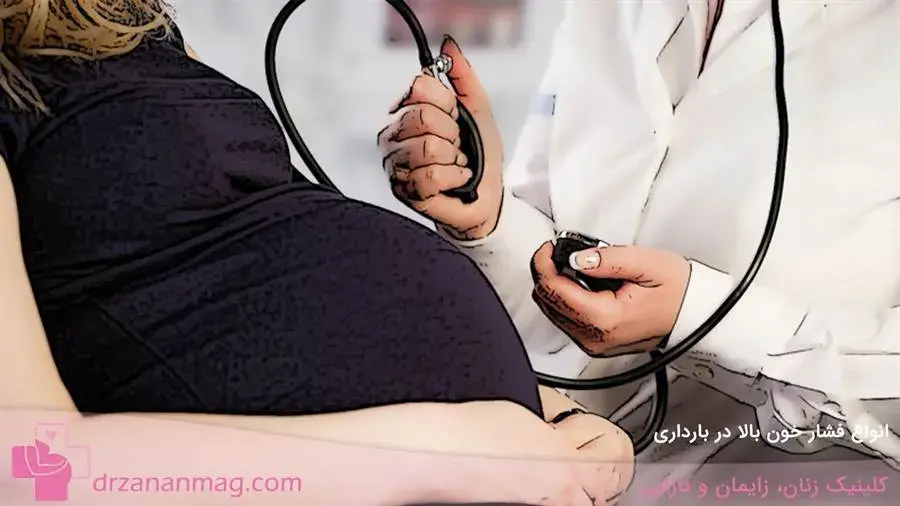 انواع فشار خون بالا در دوران بارداری چیست؟