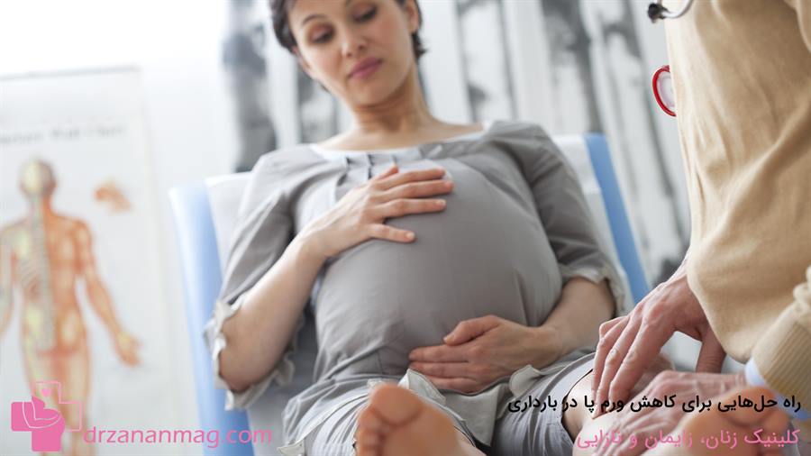 چگونه می‌توان ورم پا در بارداری را کاهش داد؟
