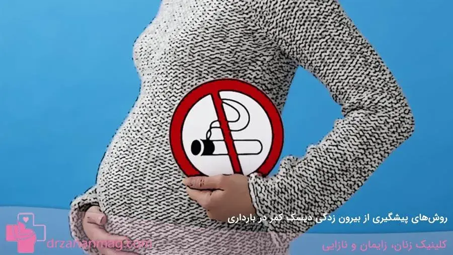 چگونه می‌توان از دیسک کمر در بارداری پیشگیری کرد؟