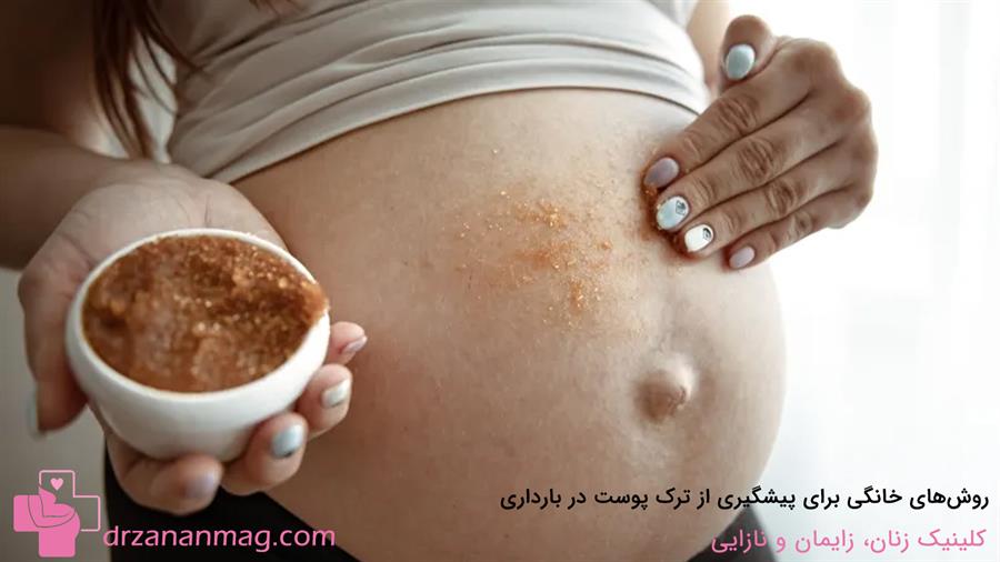 کدام روش‌های خانگی در پیشگیری از ترک‌های پوستی در بارداری موثر هستند؟