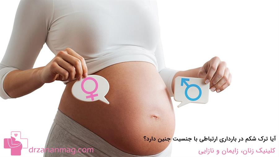 ارتباط جنسیت جنین با ترک‌های پوستی در بارداری