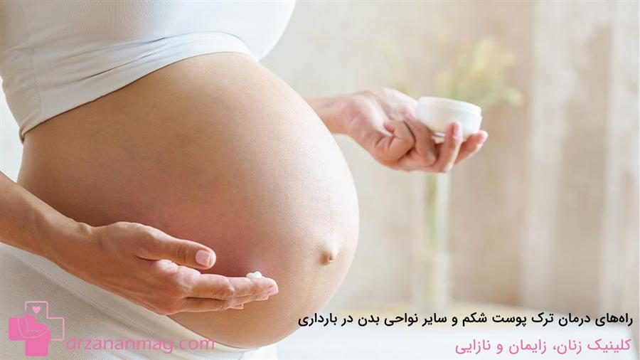 چگونه می‌توان ترک پوست شکم و سایر نواحی بدن در بارداری را درمان کرد؟