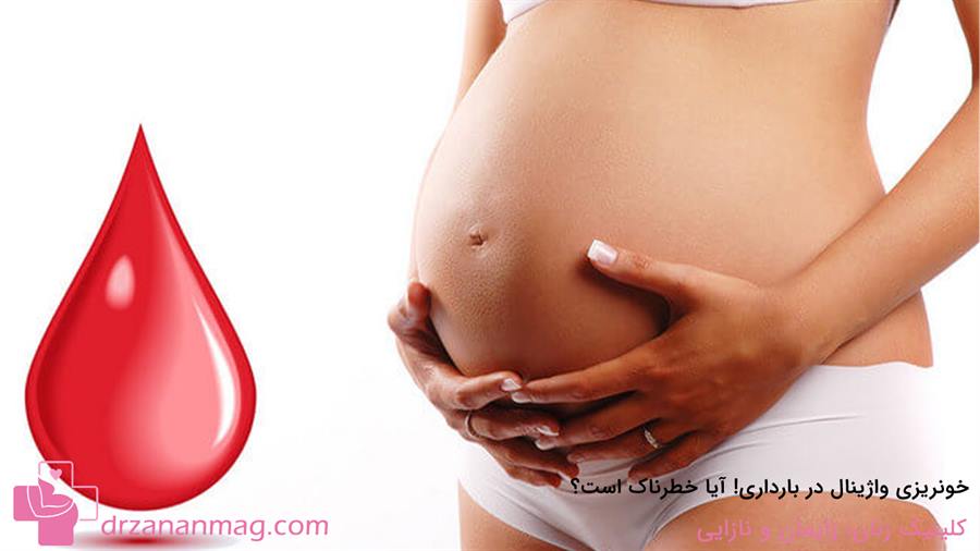 آیا خونریزی واژینال در بارداری خطرناک است؟