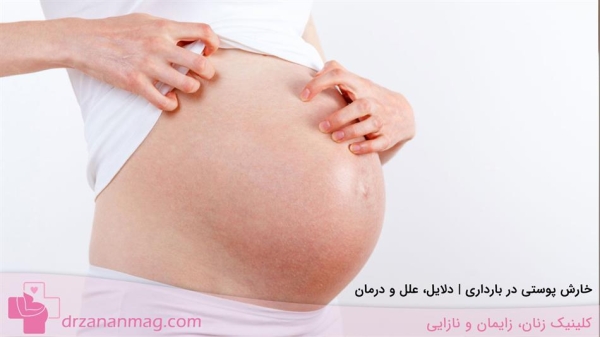 خارش پوستی در بارداری | دلایل، علل و درمان