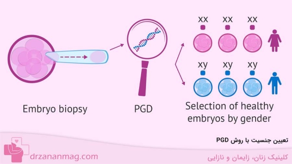 تعیین جنسیت با روش PGD